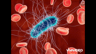 Ali - 2AC - Eschirichia Coli -R